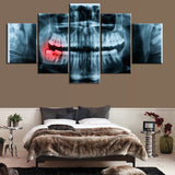 5 piece canvas x-ray Painful Teeth dental doctor picture Canvas picture painting room decor print poster wall art WD-3040