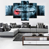 5 piece canvas x-ray Painful Teeth dental doctor picture Canvas picture painting room decor print poster wall art WD-3040