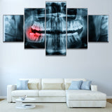 5 piece canvas x-ray Painful Teeth dental doctor picture Canvas picture painting room decor print poster wall art WD-3040
